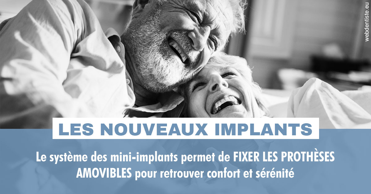 https://dr-olivier-percheron.chirurgiens-dentistes.fr/Les nouveaux implants 2