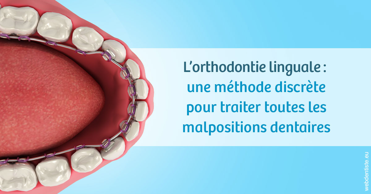 https://dr-olivier-percheron.chirurgiens-dentistes.fr/L'orthodontie linguale 1