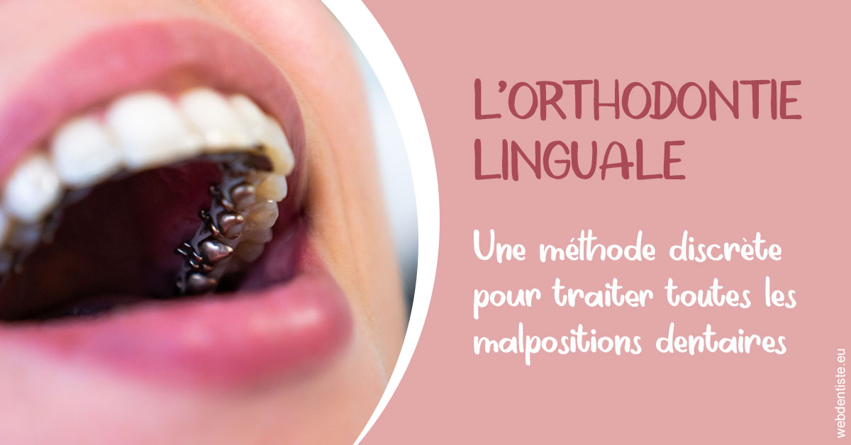 https://dr-olivier-percheron.chirurgiens-dentistes.fr/L'orthodontie linguale 2