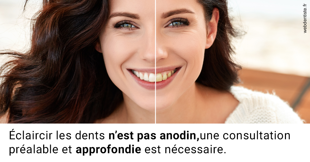 https://dr-olivier-percheron.chirurgiens-dentistes.fr/Le blanchiment 2