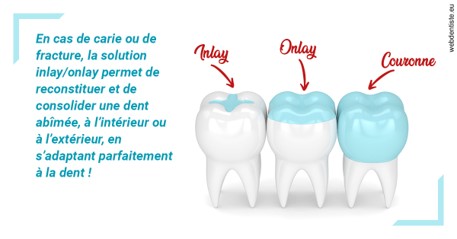 https://dr-olivier-percheron.chirurgiens-dentistes.fr/L'INLAY ou l'ONLAY