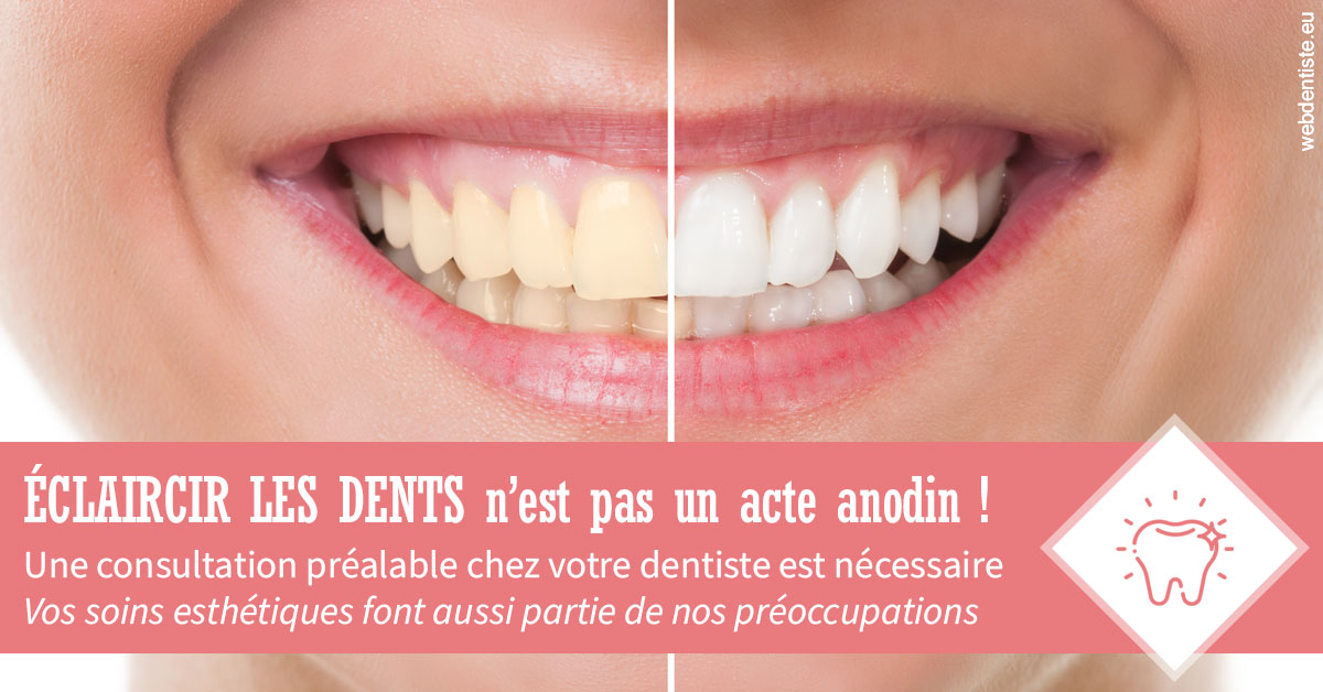 https://dr-olivier-percheron.chirurgiens-dentistes.fr/Eclaircir les dents 1
