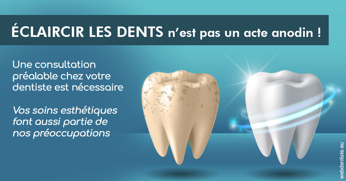 https://dr-olivier-percheron.chirurgiens-dentistes.fr/Eclaircir les dents 2