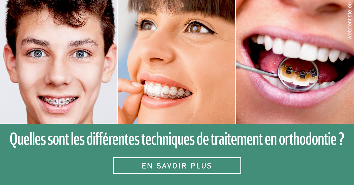 https://dr-olivier-percheron.chirurgiens-dentistes.fr/Les différentes techniques de traitement 2