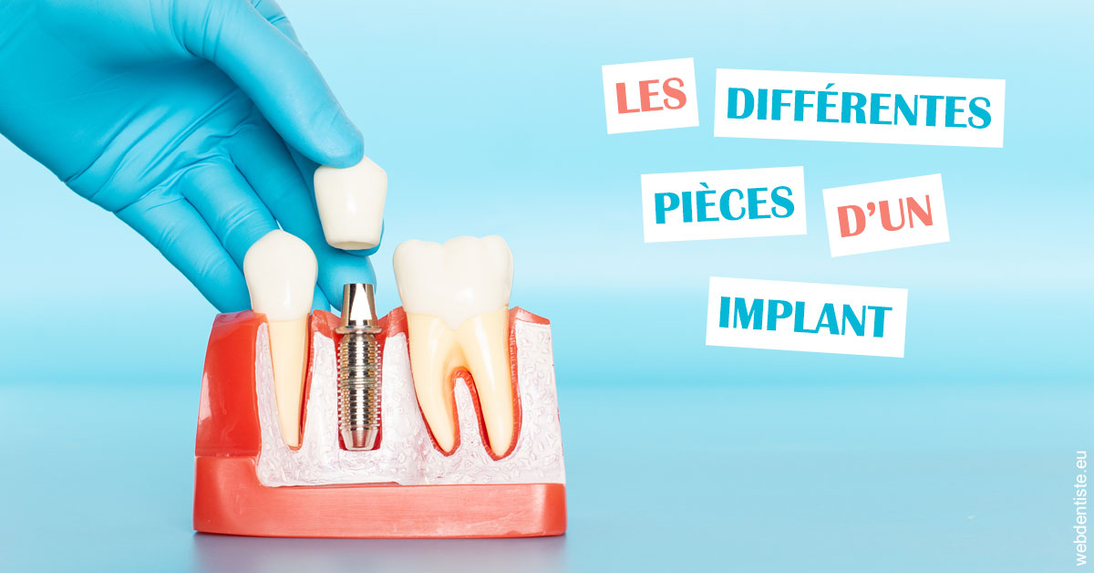 https://dr-olivier-percheron.chirurgiens-dentistes.fr/Les différentes pièces d’un implant 2