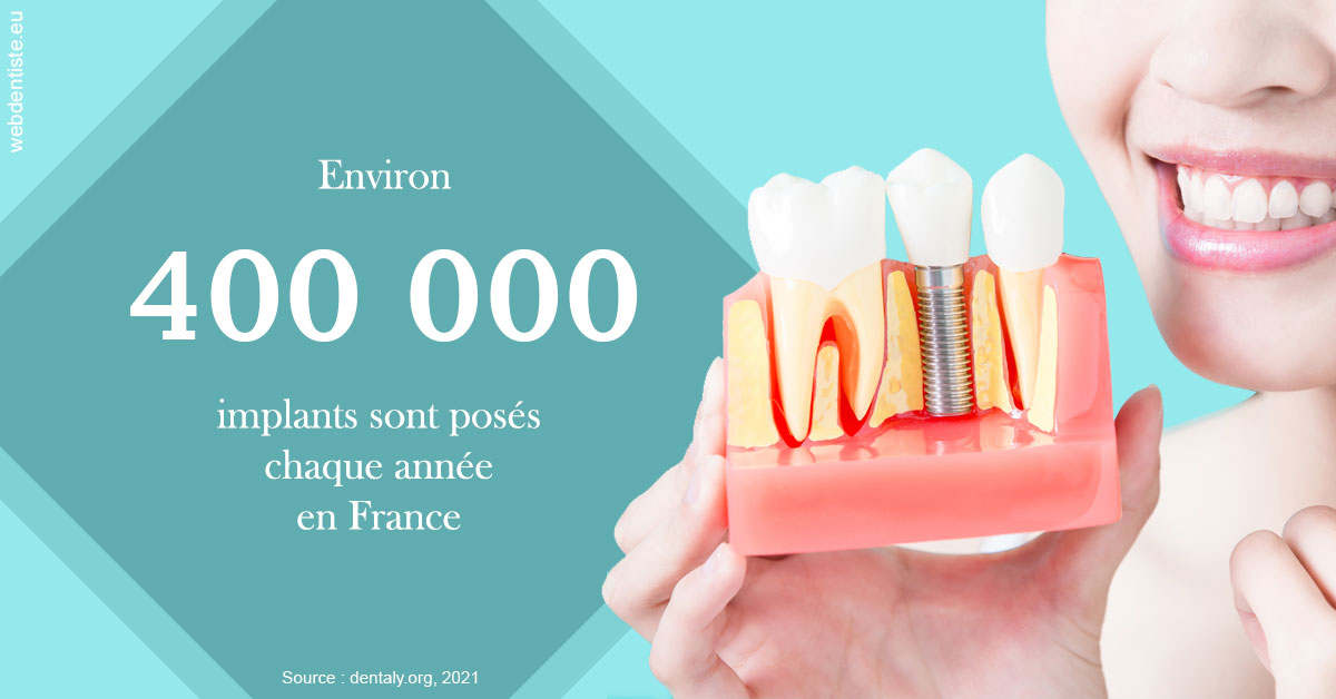 https://dr-olivier-percheron.chirurgiens-dentistes.fr/Pose d'implants en France 2
