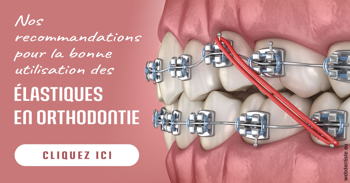 https://dr-olivier-percheron.chirurgiens-dentistes.fr/Elastiques orthodontie 2